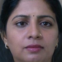 Suma, 45 years oldThanjavur, India